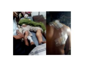 জগন্নাথপুরে দুই দফা সংঘর্ষে আহত ৫