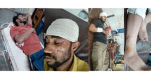সাদাপাথর পর্যটন বাজারে সংঘর্ষ 