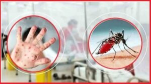 হাম ও ডেঙ্গুতে আরও ১০ জনের মৃত্যু