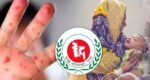 হামে আরও ৩ জনের মৃত্যু